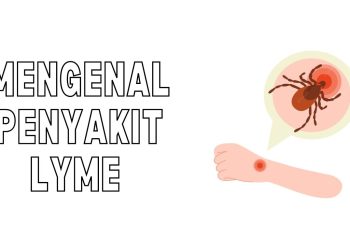 Penyakit Lyme: Penyebab, Gejala, Diagnosis, Pengobatan, dan Pencegahan