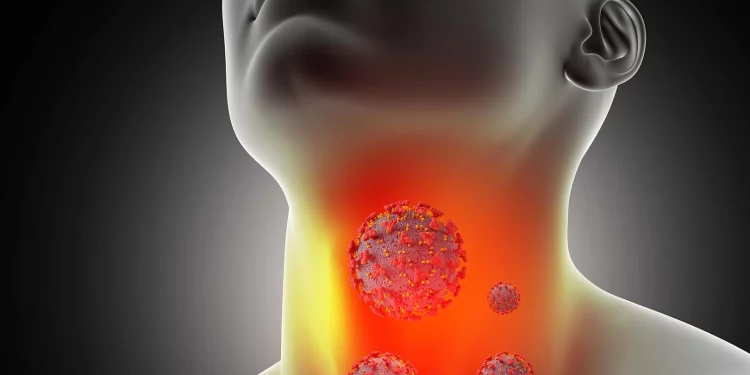 Obat Radang Tenggorokan Ampuh