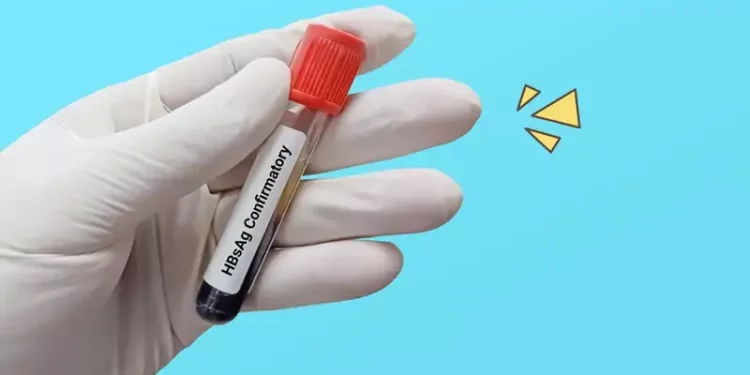Apa Itu HBsAg? Gejala, Dampak, dan Cara Mengobatinya