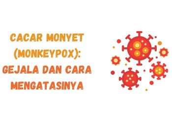 Cacar Monyet (Monkeypox): Gejala dan Cara Mengatasinya