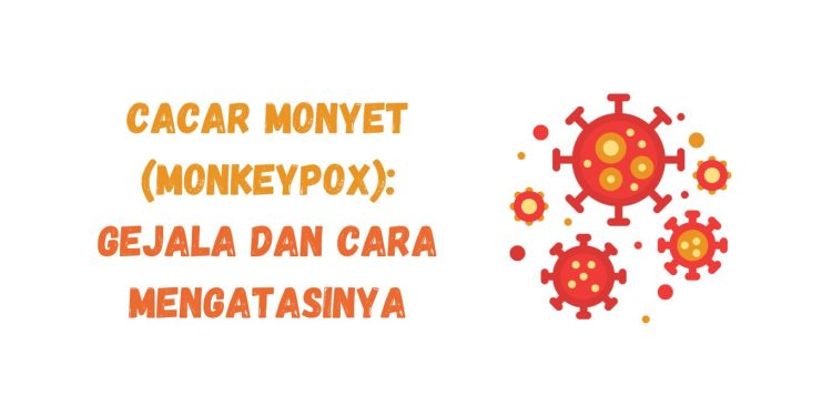 Cacar Monyet (Monkeypox): Gejala dan Cara Mengatasinya