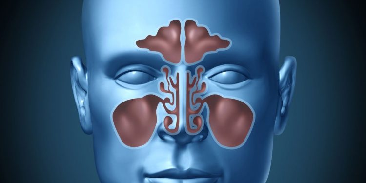 Memahami Gejala Sinusitis: Ketahui Tanda-tanda dan Pengobatannya