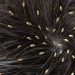 5 Tips Mengatasi Kutu Rambut Dengan Mudah