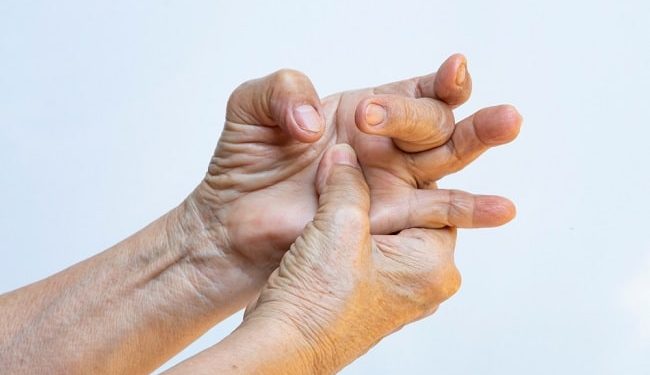 Cara Mengatasi Jari Tangan Yang Kaku Saat Bekerja