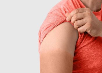 Cara Mengatasi Kulit Tangan dan Kaki yang Belang Secara Efektif