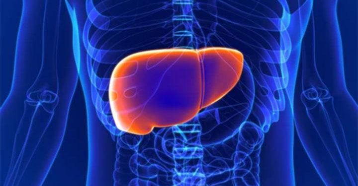 Cara Mengatasi Penyakit Liver