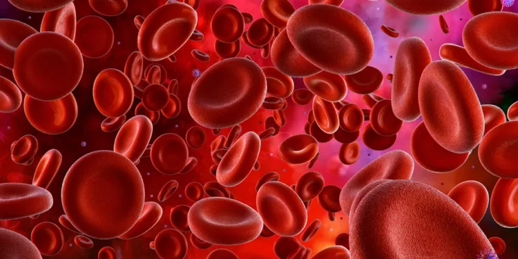 Cara Mengobati Anemia