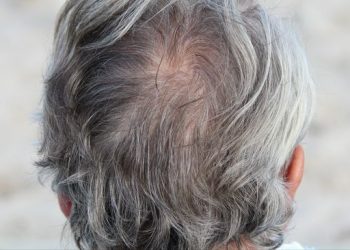 Cara Menghitamkan Rambut yang Beruban Tanpa Disemir