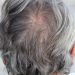 Cara Menghitamkan Rambut yang Beruban Tanpa Disemir