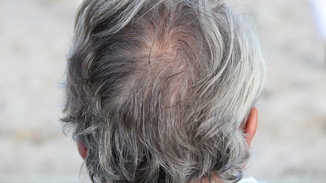 Cara Menghitamkan Rambut yang Beruban Tanpa Disemir