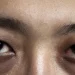 Apa Itu Penyakit Ain? Pengertian, Penyebab, dan Cara Mengatasinya