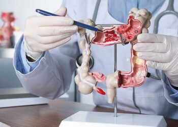 Usus Besar: Fungsi, Peran Bakteri Baik, dan Cara Menjaga Kesehatannya
