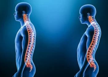 Jenis-Jenis Lordosis yang Sering Terjadi, Ini Penjelasan Lengkapnya