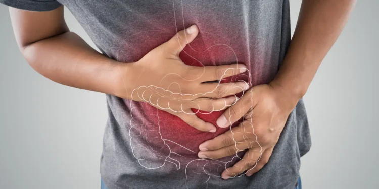 Apa Itu Radang Usus? Kenali Gejala dan Faktor Risikonya