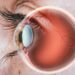 Fungsi Retina, Gangguan, dan Cara Merawatnya