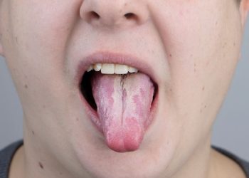 Gejala Tipes yang Harus Diwaspadai