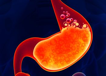 Cara Mengatasi Asam Lambung Saat Berpuasa