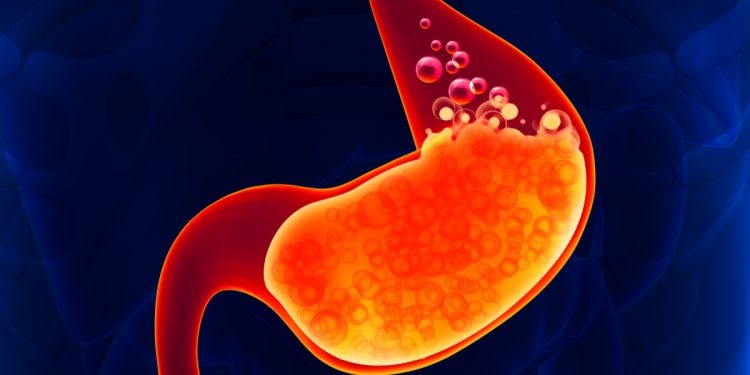 Cara Mengatasi Asam Lambung Saat Berpuasa