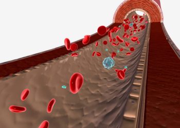 Anemia Aplastik Gejala dan Penyebab Penyakit Langka Ini