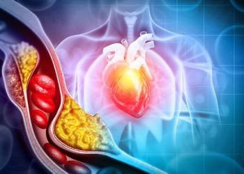 Mengenal Kolesterol LDL: Penyebab Dan Cara Mencegahnya!