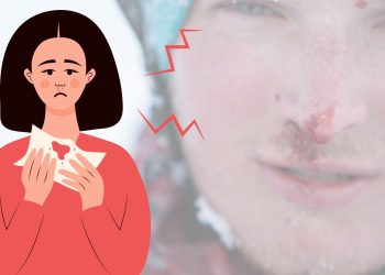 Pertolongan Pertama Saat Mimisan Agar Cepat Berhenti