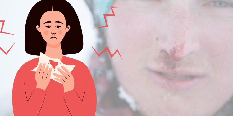 Pertolongan Pertama Saat Mimisan Agar Cepat Berhenti