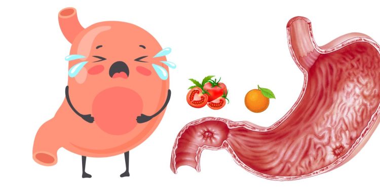 10 Makanan yang Sebaiknya Dihindari Saat Perut Kosong