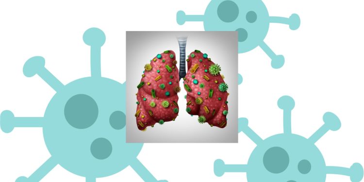 Kebiasaan yang Menyebabkan Paru-Paru Basah