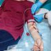 Cuci Darah Pengertian , Penyebab, dan Resikonya