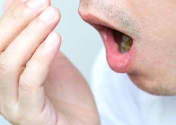 Cara Agar Mulut Tidak Bau Saat Puasa Ramadan