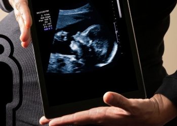 Apakah Umur Wanita Mempengaruhi Kehamilan Simak Fakta Medisnya