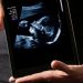 Apakah Umur Wanita Mempengaruhi Kehamilan Simak Fakta Medisnya