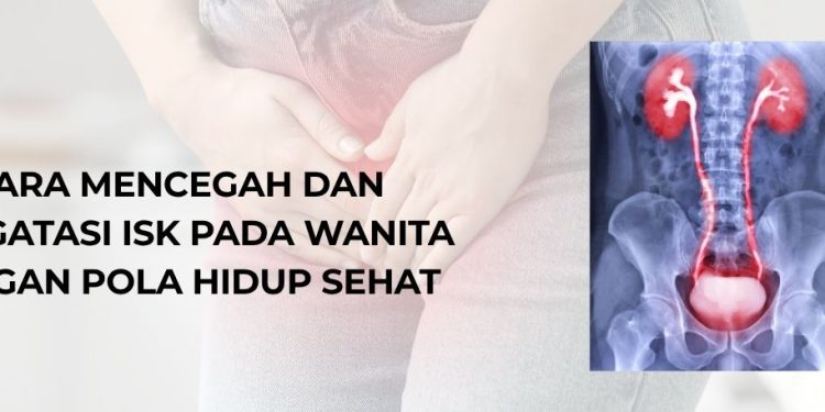 Cara Mencegah dan Mengatasi ISK pada Wanita dengan Pola Hidup Sehat