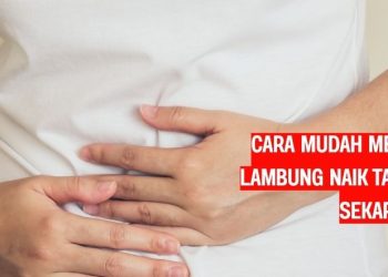 Cara Mudah Mengatasi Asam Lambung Naik Tanpa Obat, Coba Sekarang