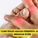 Makanan yang Boleh Makan Penderita Asam Urat untuk Redakan Nyeri