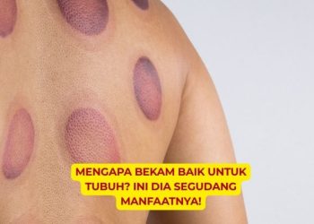 Mengapa Bekam Baik untuk Tubuh Ini Dia Segudang Manfaatnya!