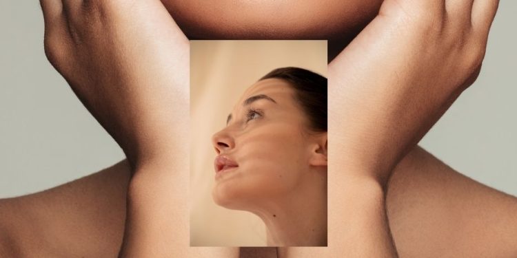 Kulit Belang Akibat Matahari? Ini Cara Alami Mengembalikan Warnanya
