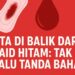 Fakta di Balik Darah Haid Hitam Tak Selalu Tanda Bahaya