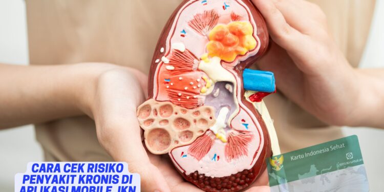 Cara Cek Risiko Penyakit Kronis di Aplikasi Mobile JKN