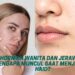 Hormon Wanita dan Jerawat Mengapa Muncul Saat Menjelang Haid