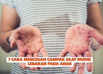 7 Cara Mencegah Campak Saat Mudik Lebaran pada Anak
