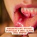 Sariawan Saat Puasa? Penyebab & Obat Alami yang Ampuh