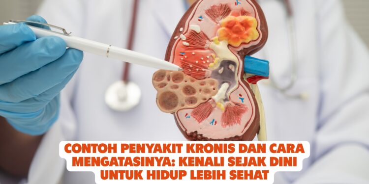 Contoh Penyakit Kronis dan Cara Mengatasinya: Kenali Sejak Dini untuk Hidup Lebih Sehat